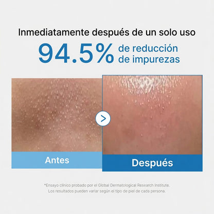 Aceite Limpiador Poro Cero Anti-Puntos Negros